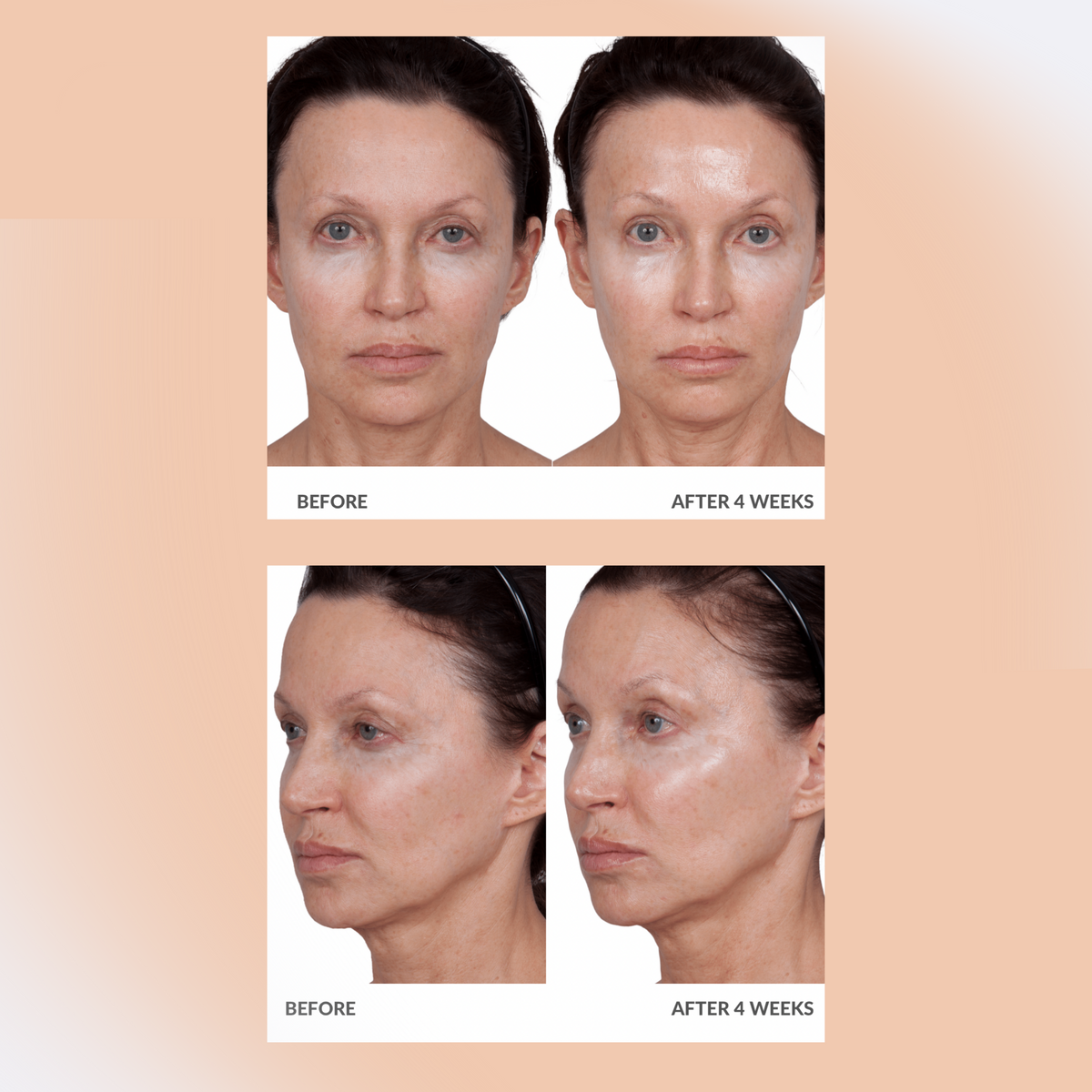 Volumagen Volumizing Essence Facial Treatment Discs Duo