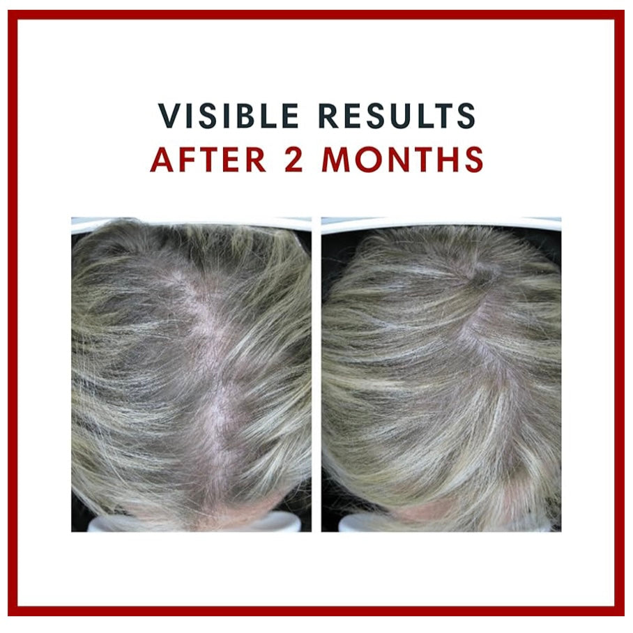 Consult Health Biotin Gain supplement for daily beauty support, helping promote healthy-looking hair, skin and nails with convenient biotin nutrition.