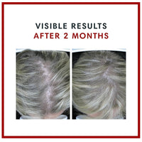 Consult Health Biotin Gain supplement for daily beauty support, helping promote healthy-looking hair, skin and nails with convenient biotin nutrition.
