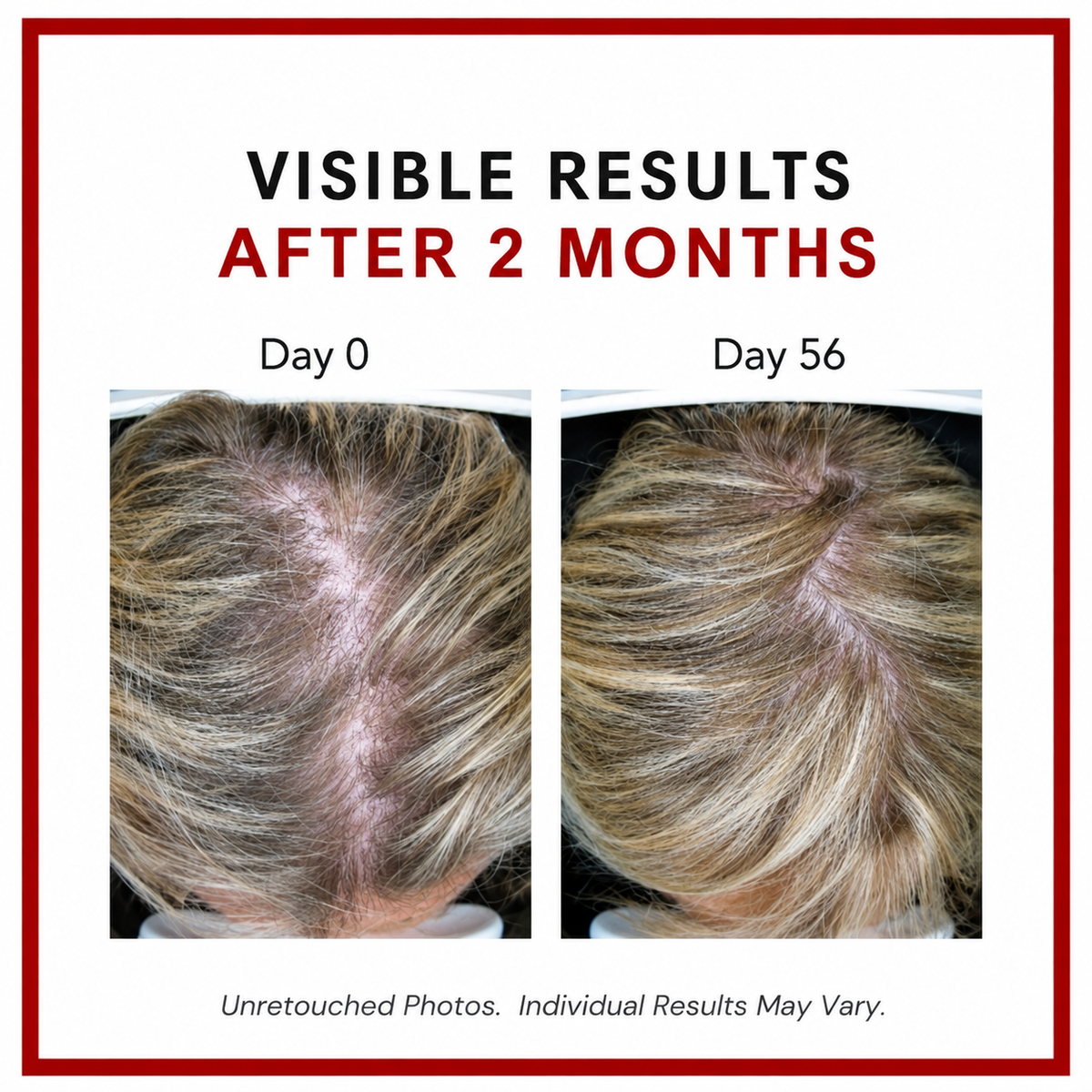 Consult Health Biotin Gain supplement for daily beauty support, helping promote healthy-looking hair, skin and nails with convenient biotin nutrition. Consult Beaute Copperum 29 Rejuvenating Eye Treatment with Lash Enhancing Peptides and visible wrinkle repair complex