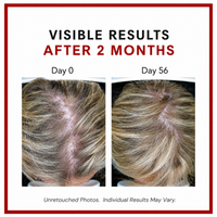 Consult Health Biotin Gain supplement for daily beauty support, helping promote healthy-looking hair, skin and nails with convenient biotin nutrition. Consult Beaute Copperum 29 Rejuvenating Eye Treatment with Lash Enhancing Peptides and visible wrinkle repair complex
