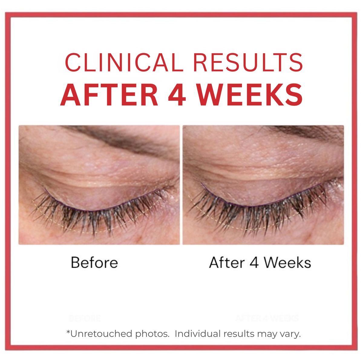 Before and after comparison of eyelashes with text indicating clinical results after 4 weeks.  Copperum 29 eye treatment tube on a white background.  Copper.  Lash Enhancing Peptides.  Consult Beaute by Dr Terry Dubrow and Heather Dubrow.