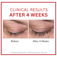 Before and after comparison of eyelashes with text indicating clinical results after 4 weeks.  Copperum 29 eye treatment tube on a white background.  Copper.  Lash Enhancing Peptides.  Consult Beaute by Dr Terry Dubrow and Heather Dubrow.