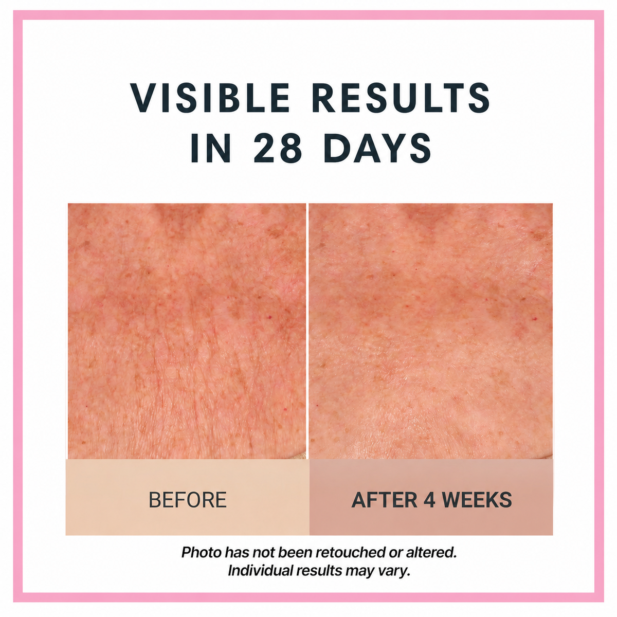 Champagne Lift Body Crème by Consult Beaute, Dr. Terry Dubrow & Heather Dubrow – Firming Body Moisturizer for Smoother, Tighter-Looking, Radiant Skin
