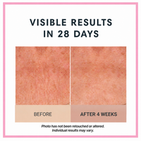 Champagne Lift Body Crème by Consult Beaute, Dr. Terry Dubrow & Heather Dubrow – Firming Body Moisturizer for Smoother, Tighter-Looking, Radiant Skin
