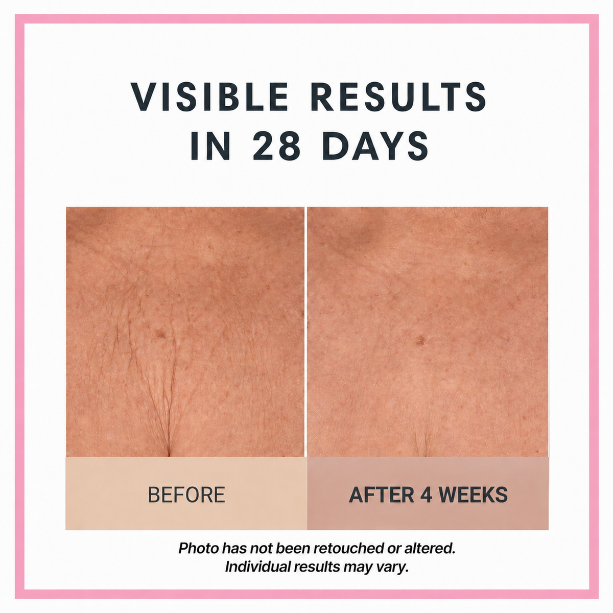Champagne Lift Body Crème by Consult Beaute, Dr. Terry Dubrow & Heather Dubrow – Firming Body Moisturizer for Smoother, Tighter-Looking, Radiant Skin
