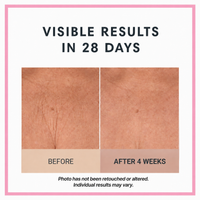 Champagne Lift Body Crème by Consult Beaute, Dr. Terry Dubrow & Heather Dubrow – Firming Body Moisturizer for Smoother, Tighter-Looking, Radiant Skin

