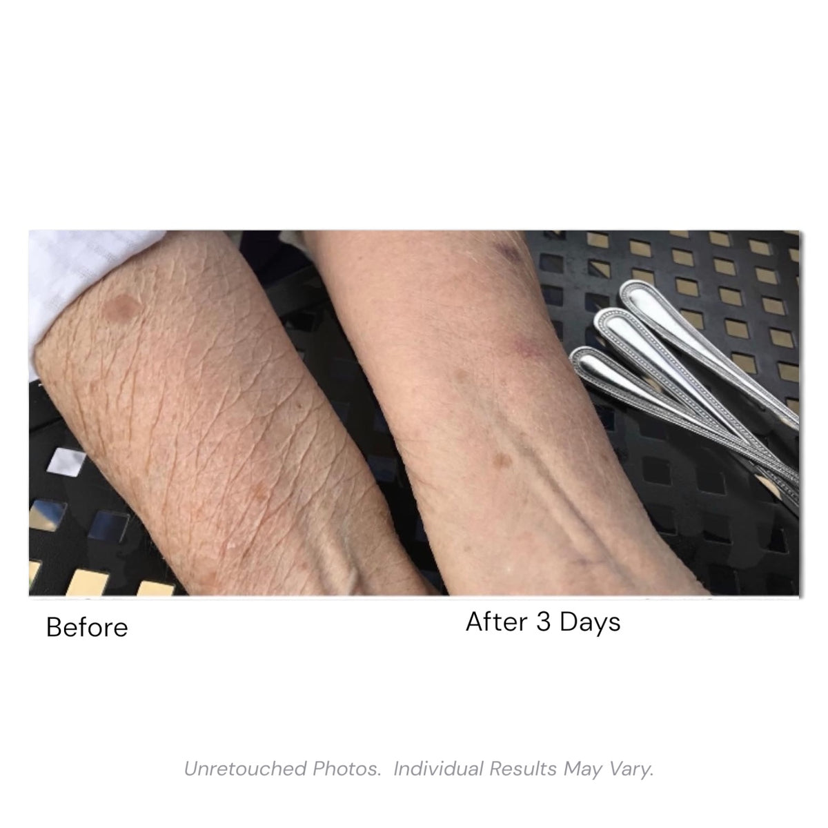 Champagne Lift Body Crème by Consult Beaute, Dr. Terry Dubrow & Heather Dubrow – Firming Body Moisturizer for Smoother, Tighter-Looking, Radiant Skin
