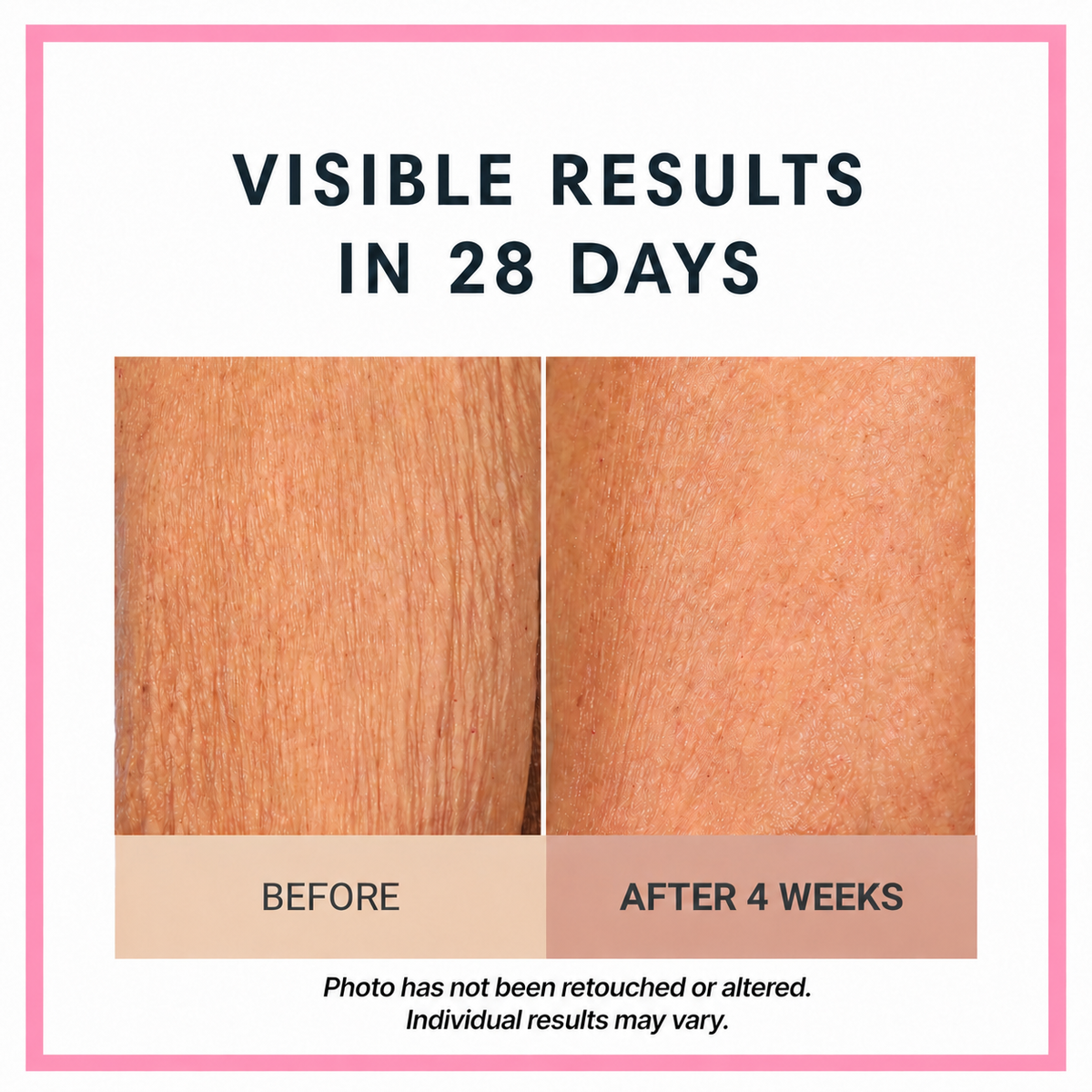 Champagne Lift Body Crème by Consult Beaute, Dr. Terry Dubrow & Heather Dubrow – Firming Body Moisturizer for Smoother, Tighter-Looking, Radiant Skin
