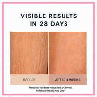 Champagne Lift Body Crème by Consult Beaute, Dr. Terry Dubrow & Heather Dubrow – Firming Body Moisturizer for Smoother, Tighter-Looking, Radiant Skin
