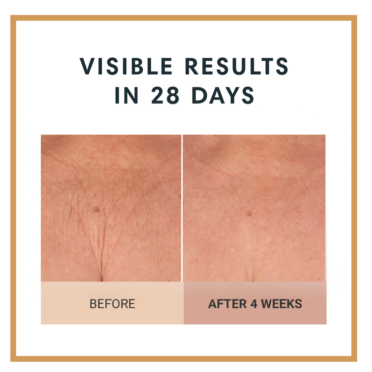 Before and after comparison of skin texture with text 'Visible Results in 28 Days' on a white background.  Firming Body Crème by Dr Terry Dubrow and Heather Dubrow.  Original.  Rose.  Vanilla.  Santal.  Unscented.  Singles and Duos.  Buy More Save More.  Lifting Firming Body Cream.  Pink Pepperslim.  Before and After.  Visible Results.  Sculpt and Contour the body with new elasticity and hydration.  Erase Crepiness.  Slimming Effect.  