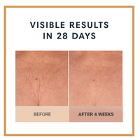 Before and after comparison of skin texture with text 'Visible Results in 28 Days' on a white background.  Firming Body Crème by Dr Terry Dubrow and Heather Dubrow.  Original.  Rose.  Vanilla.  Santal.  Unscented.  Singles and Duos.  Buy More Save More.  Lifting Firming Body Cream.  Pink Pepperslim.  Before and After.  Visible Results.  Sculpt and Contour the body with new elasticity and hydration.  Erase Crepiness.  Slimming Effect.  