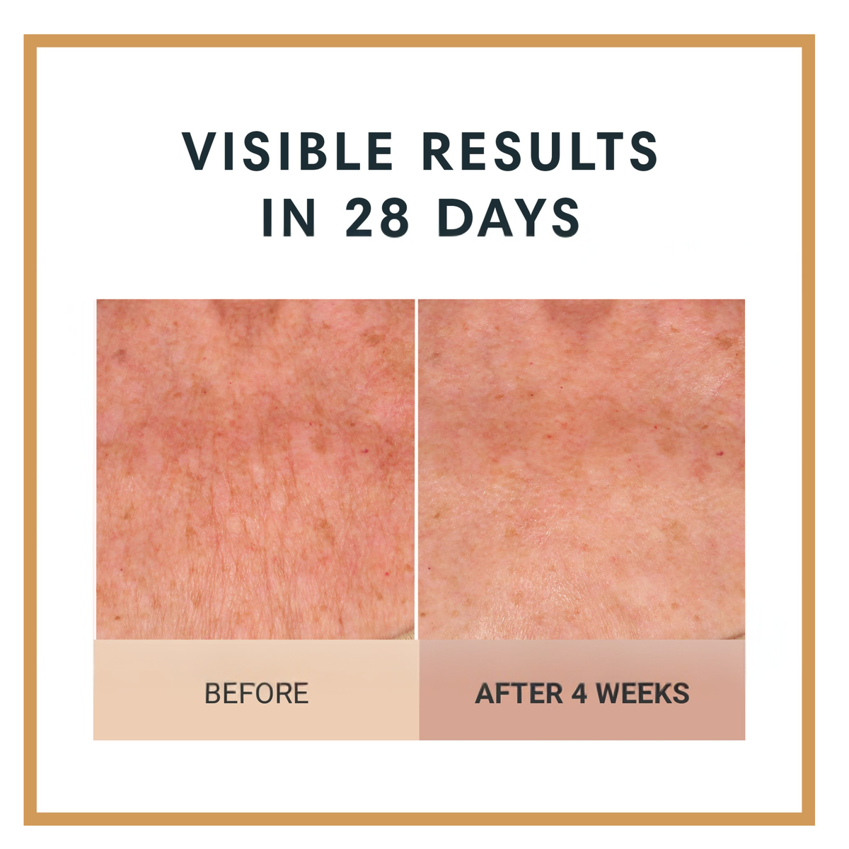 Before and after comparison of skin texture with text 'Visible Results in 28 Days' on a white background.  Firming Body Crème by Dr Terry Dubrow and Heather Dubrow.  Original.  Rose.  Vanilla.  Santal.  Unscented.  Singles and Duos.  Buy More Save More.  Lifting Firming Body Cream.  Pink Pepperslim.  Before and After.  Visible Results.  Sculpt and Contour the body with new elasticity and hydration.  Erase Crepiness.  Slimming Effect.  