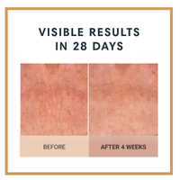 Before and after comparison of skin texture with text 'Visible Results in 28 Days' on a white background.  Firming Body Crème by Dr Terry Dubrow and Heather Dubrow.  Original.  Rose.  Vanilla.  Santal.  Unscented.  Singles and Duos.  Buy More Save More.  Lifting Firming Body Cream.  Pink Pepperslim.  Before and After.  Visible Results.  Sculpt and Contour the body with new elasticity and hydration.  Erase Crepiness.  Slimming Effect.  