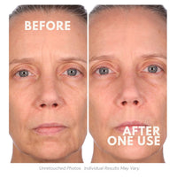 Consult Beaute Volumagen™ Miracle Plumping Balm with Hyaluronic Acid, Marine Collagen and Ceramides to deeply hydrate, smooth and visibly plump dry, depleted-looking skin.