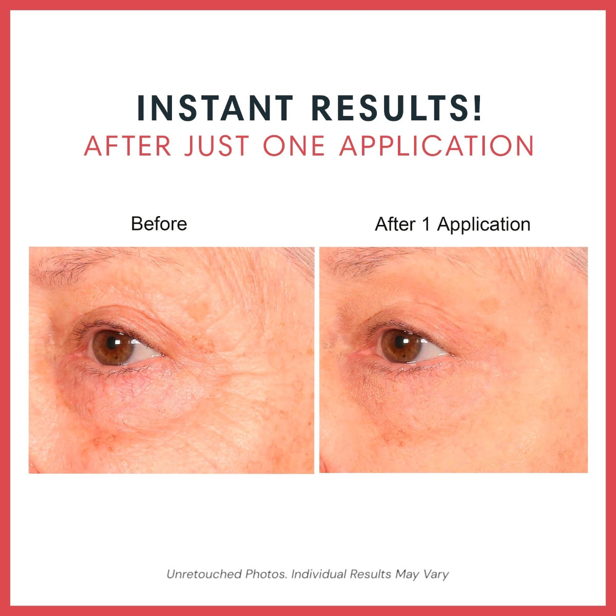 Consult Beaute REAL-EYEZ-ATION Tinted Firming Eye Gel to visibly lift, tighten and smooth the eye area while helping reduce the look of puffiness and shadows.