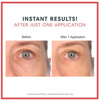 Consult Beaute REAL-EYEZ-ATION Tinted Firming Eye Gel to visibly lift, tighten and smooth the eye area while helping reduce the look of puffiness and shadows.