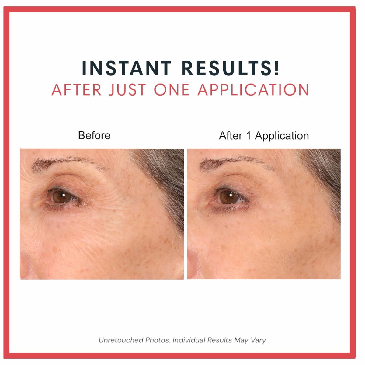 Consult Beaute REAL-EYEZ-ATION Tinted Firming Eye Gel to visibly lift, tighten and smooth the eye area while helping reduce the look of puffiness and shadows.
