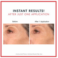 Consult Beaute REAL-EYEZ-ATION Tinted Firming Eye Gel to visibly lift, tighten and smooth the eye area while helping reduce the look of puffiness and shadows.