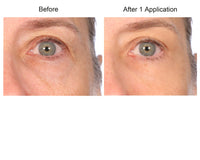 Consult Beaute REAL-EYEZ-ATION Tinted Firming Eye Gel to visibly lift, tighten and smooth the eye area while helping reduce the look of puffiness and shadows.