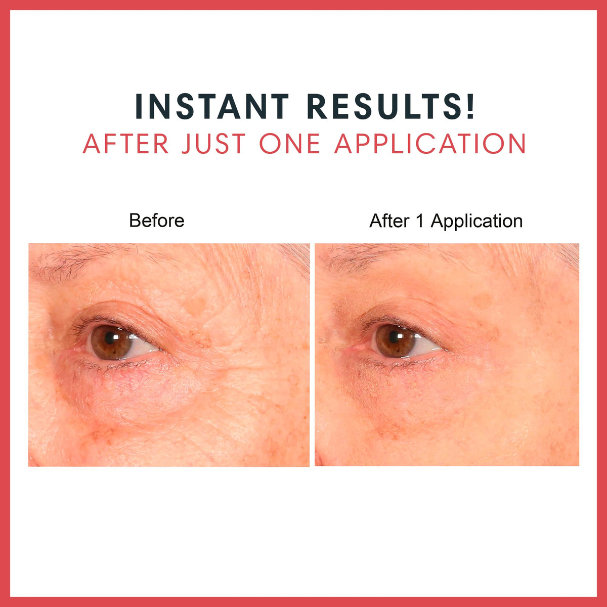Consult Beaute REAL-EYEZ-ATION Tinted Firming Eye Gel to visibly lift, tighten and smooth the eye area while helping reduce the look of puffiness and shadows.