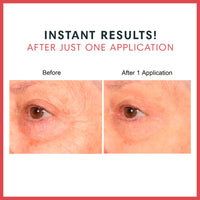 Consult Beaute REAL-EYEZ-ATION Tinted Firming Eye Gel to visibly lift, tighten and smooth the eye area while helping reduce the look of puffiness and shadows.
