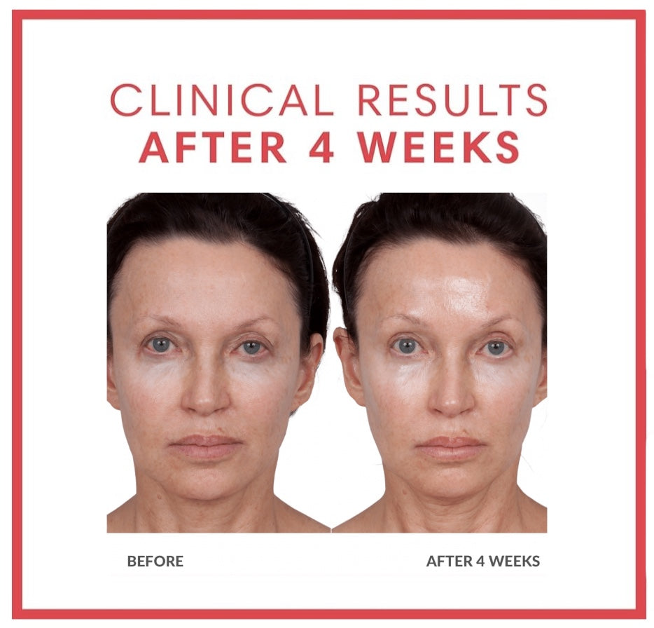 Volumagen Volumizing Essence Facial Treatment Discs Duo