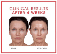 Volumagen Volumizing Essence Facial Treatment Discs Duo