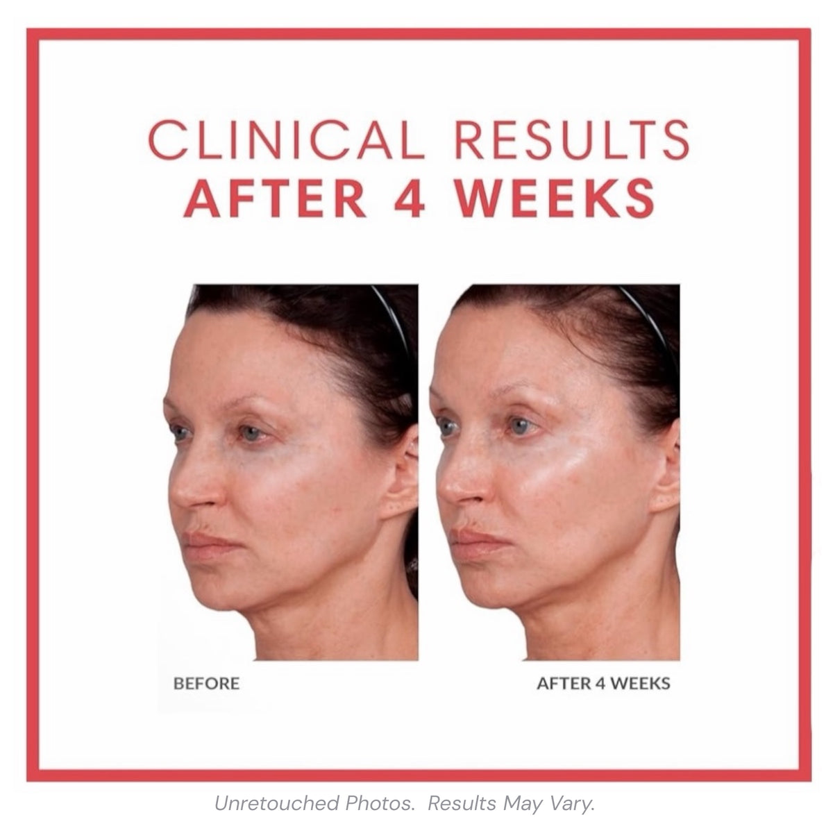Consult Beaute Volumagen Concentrate facial serum for visibly plumper, smoother, more youthful-looking skin.