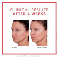 Consult Beaute Volumagen Concentrate facial serum for visibly plumper, smoother, more youthful-looking skin.