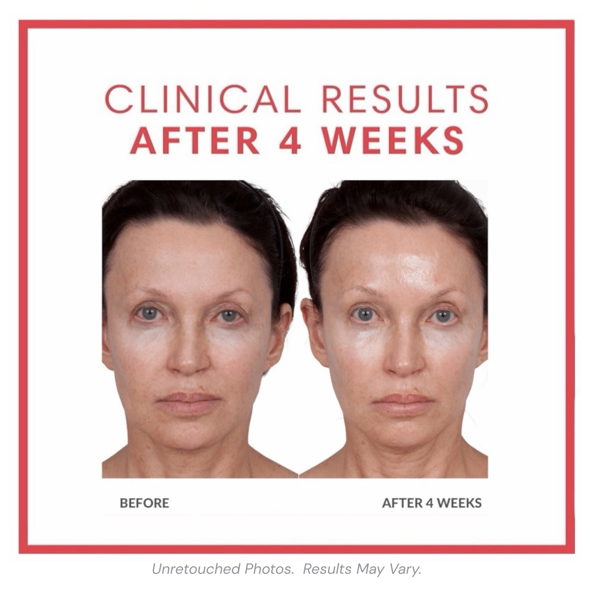 Consult Beaute Volumagen Concentrate facial serum for visibly plumper, smoother, more youthful-looking skin.