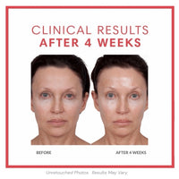 Consult Beaute Volumagen Concentrate facial serum for visibly plumper, smoother, more youthful-looking skin.