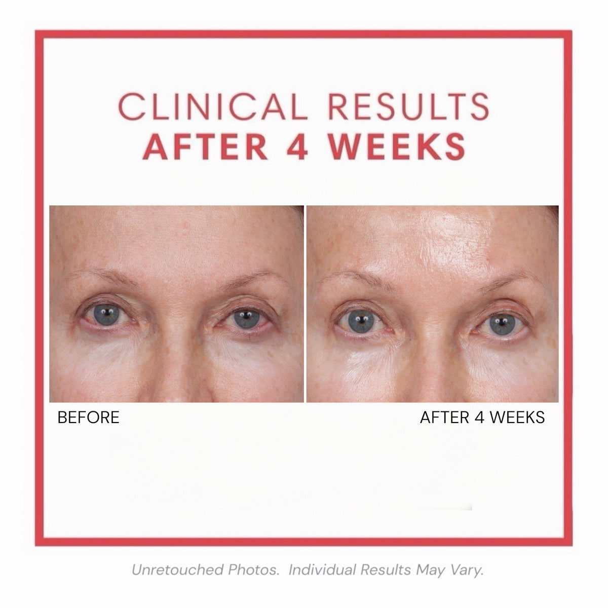 Consult Beaute Volumagen™ Volumizing Collagen Eye Cream to hydrate, smooth and visibly plump the delicate eye area while helping soften the look of fine lines and loss of volume.
