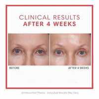 Consult Beaute Volumagen™ Volumizing Collagen Eye Cream to hydrate, smooth and visibly plump the delicate eye area while helping soften the look of fine lines and loss of volume.
