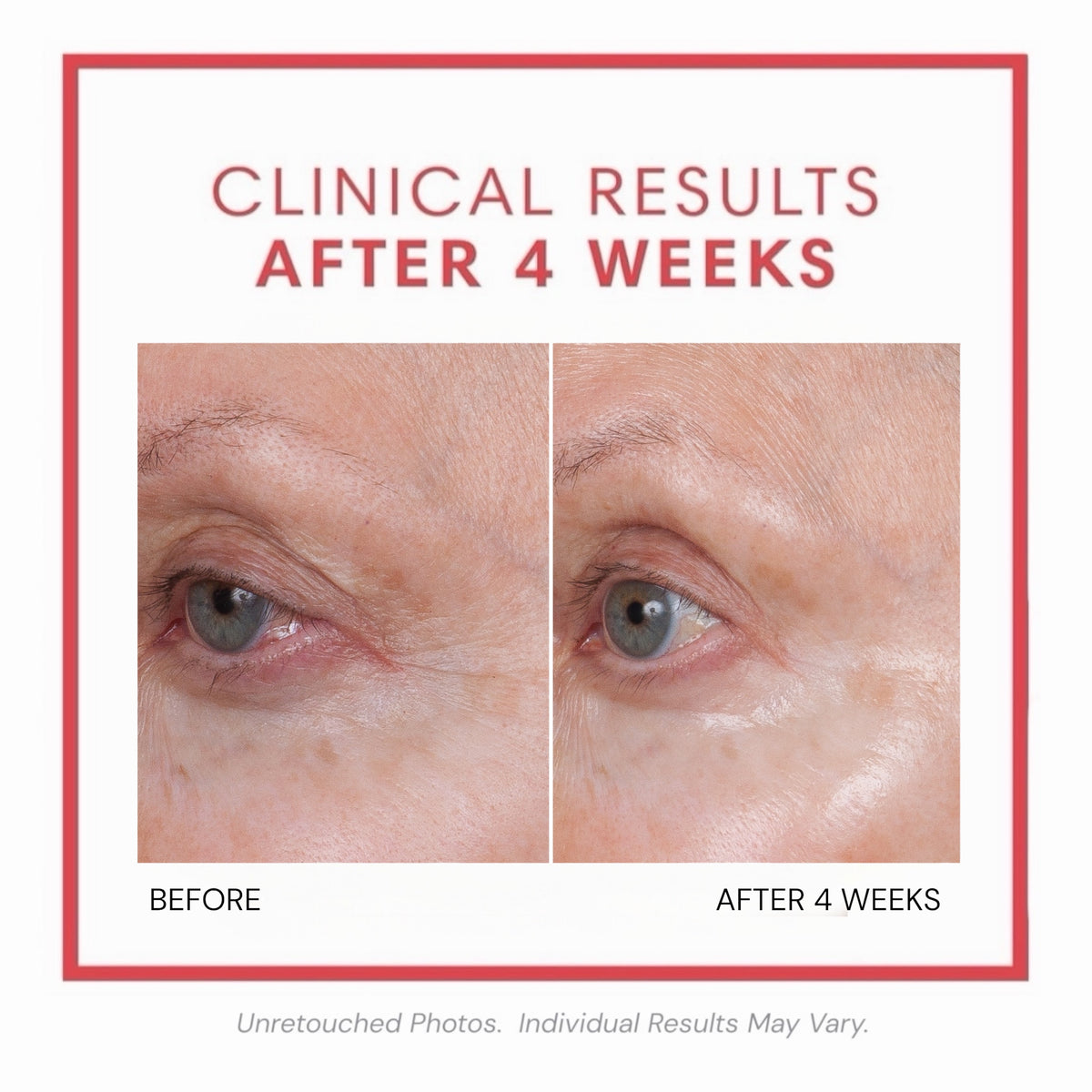 Consult Beaute Volumagen™ Volumizing Collagen Eye Cream to hydrate, smooth and visibly plump the delicate eye area while helping soften the look of fine lines and loss of volume.
