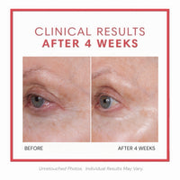 Consult Beaute Volumagen™ Volumizing Collagen Eye Cream to hydrate, smooth and visibly plump the delicate eye area while helping soften the look of fine lines and loss of volume.
