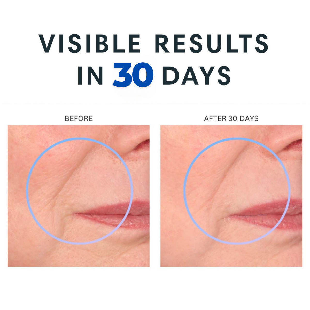 Before and after comparison of skin texture with text 'Visible Results in 30 Days' on a white background.  CoQ10 Xterna Q Face and Neck Cream.  Consult Beaute by Dr Terry Dubrow and Heather Dubrow