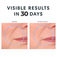 Before and after comparison of an eye area showing visible wrinkles around the eye, with the text 'VISIBLE RESULTS IN 30 DAYS' above and labels 'BEFORE' and 'AFTER 30 DAYS' above each panel.  Consult Beaute XTERNA-Q™ Topical CoQ10 Face & Neck Cream with antioxidant support to deeply moisturize, strengthen the skin barrier and visibly firm, smooth and revitalize aging skin.