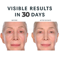 Before and after comparison of an eye area showing visible wrinkles around the eye, with the text 'VISIBLE RESULTS IN 30 DAYS' above and labels 'BEFORE' and 'AFTER 30 DAYS' above each panel.  Consult Beaute XTERNA-Q™ Topical CoQ10 Face & Neck Cream with antioxidant support to deeply moisturize, strengthen the skin barrier and visibly firm, smooth and revitalize aging skin.