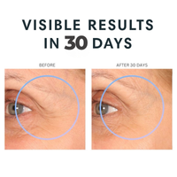 Before and after comparison of an eye area showing visible wrinkles around the eye, with the text 'VISIBLE RESULTS IN 30 DAYS' above and labels 'BEFORE' and 'AFTER 30 DAYS' above each panel.  Consult Beaute XTERNA-Q™ Topical CoQ10 Face & Neck Cream with antioxidant support to deeply moisturize, strengthen the skin barrier and visibly firm, smooth and revitalize aging skin.