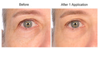 Consult Beaute REAL-EYEZ-ATION Tinted Firming Eye Gel to visibly lift, tighten and smooth the eye area while helping reduce the look of puffiness and shadows.