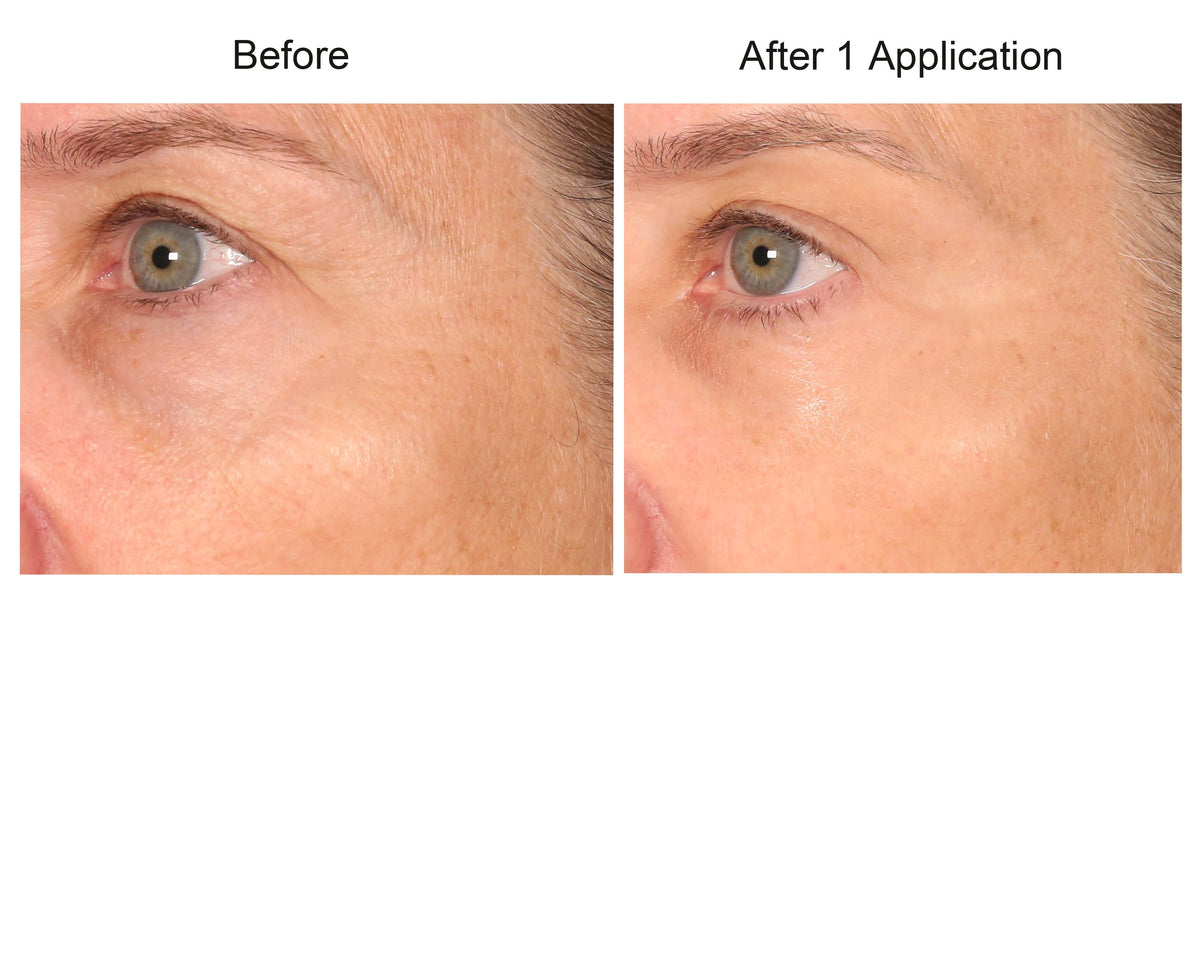Consult Beaute REAL-EYEZ-ATION Tinted Firming Eye Gel to visibly lift, tighten and smooth the eye area while helping reduce the look of puffiness and shadows.