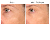 Consult Beaute REAL-EYEZ-ATION Tinted Firming Eye Gel to visibly lift, tighten and smooth the eye area while helping reduce the look of puffiness and shadows.