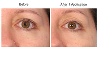Consult Beaute REAL-EYEZ-ATION Tinted Firming Eye Gel to visibly lift, tighten and smooth the eye area while helping reduce the look of puffiness and shadows.