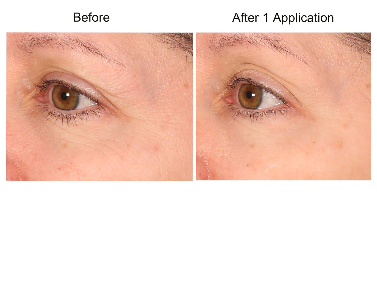 Consult Beaute REAL-EYEZ-ATION Tinted Firming Eye Gel to visibly lift, tighten and smooth the eye area while helping reduce the look of puffiness and shadows.