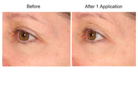Consult Beaute REAL-EYEZ-ATION Tinted Firming Eye Gel to visibly lift, tighten and smooth the eye area while helping reduce the look of puffiness and shadows.