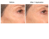 Consult Beaute REAL-EYEZ-ATION Tinted Firming Eye Gel to visibly lift, tighten and smooth the eye area while helping reduce the look of puffiness and shadows.