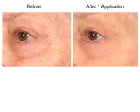 Consult Beaute REAL-EYEZ-ATION Tinted Firming Eye Gel to visibly lift, tighten and smooth the eye area while helping reduce the look of puffiness and shadows.